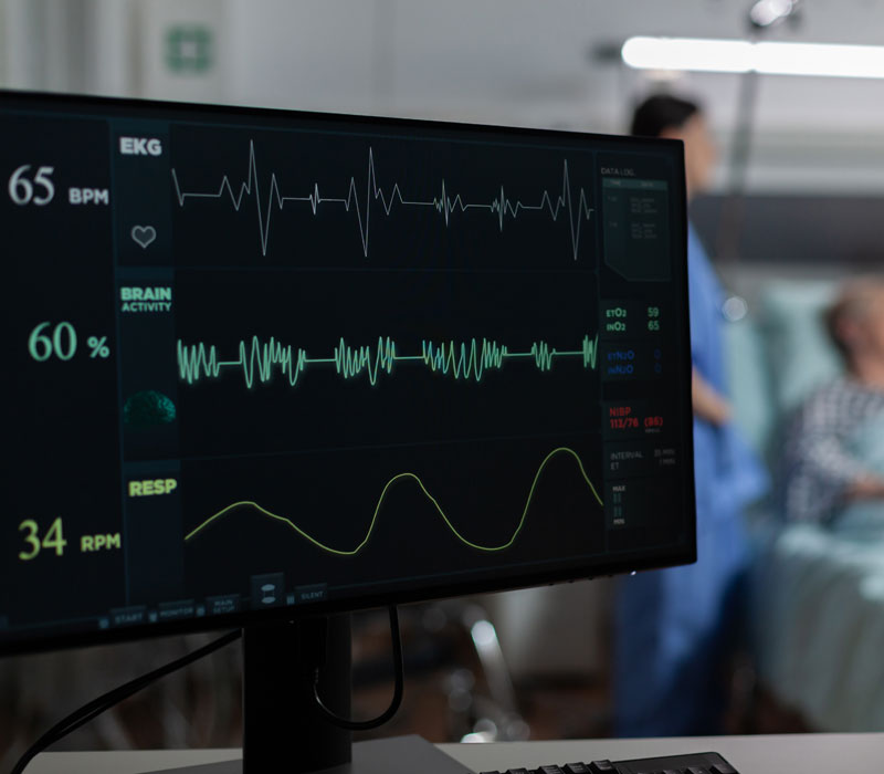 ecg-img2-2025